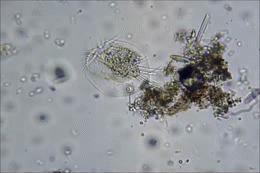 microorganism magnified