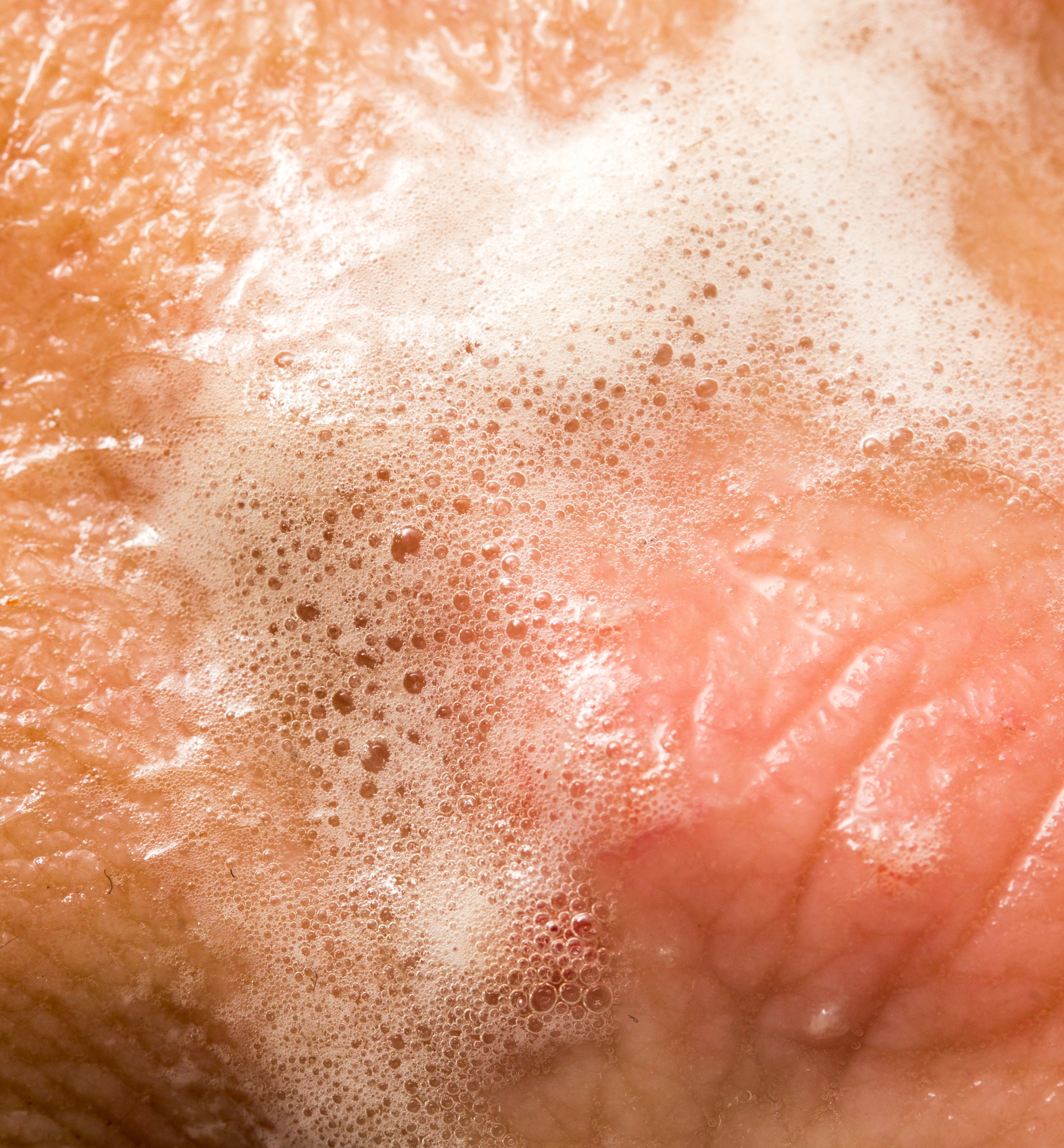 10 Ingenious Uses for Hydrogen Peroxide Spray